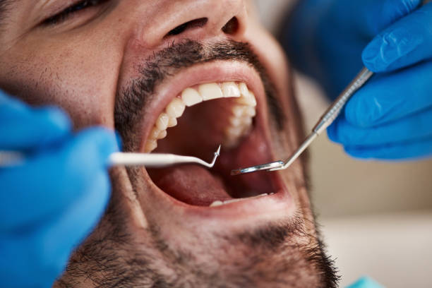 Best Emergency Tooth Extraction  in East Niles, CA